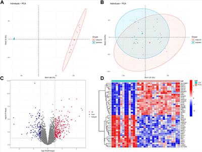 Identification of immune-related biomarkers for glaucoma using gene expression profiling